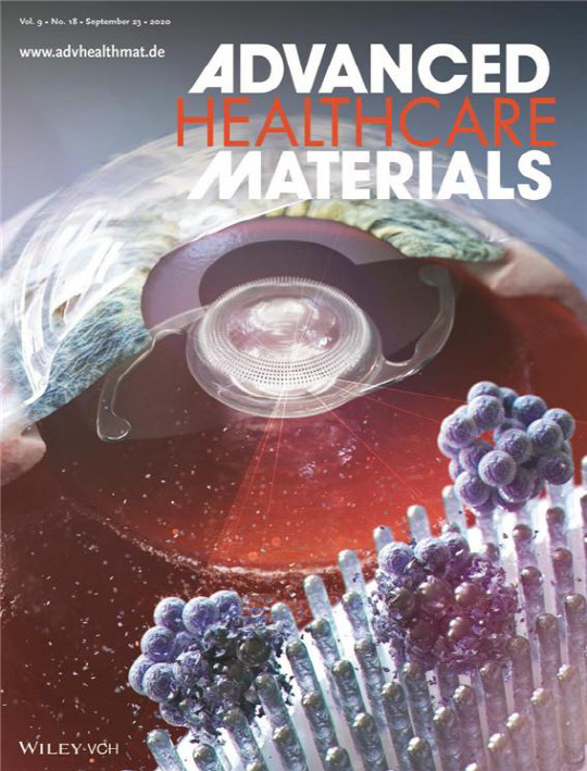 백내장 수술 때 발생하는 병원성 박테리아 감염을 줄이기 위해 반도체 공정기술을 활용해 개발된 '항균성 인공수정체' 관련 연구성과가 실린 국제 학술지 표지.  나노종합기술원 제공